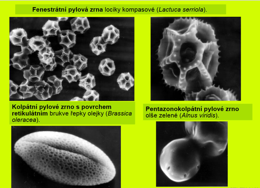 Studie pylovho zrna - autor PaedDr. Ing. Vladimr Vinter, Dr.